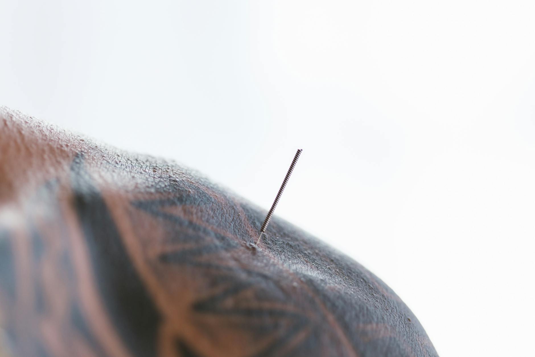 shanghai massage tcm acupuncture